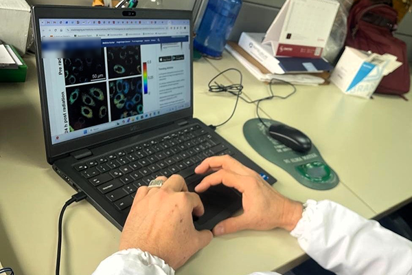 El equipo identifica la diferencia en la fluorescencia de células infectadas con Plasmodium falciparum, el parásito que causa la malaria. Foto cortesía de Miguel Ángel Garrido Tamayo.