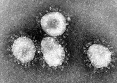 Al coronavirus se le denomina así por tener aspecto de corona cuando se le mira en el microscopio. Foto tomada de: bit.ly/2uHJii7